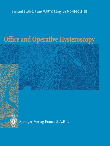 bokomslag Office and Operative Hysteroscopy