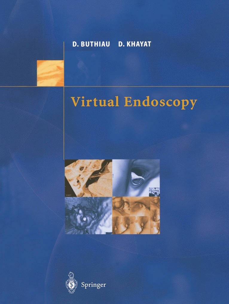 Didier Buthiau, David Khayat - Virtual Endoscopy, Häftad