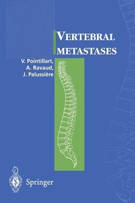Vincent Pointillart, Alain Ravaud, Jean Palussiere, Vincent Pointillart, Alain Ravaud - Vertebral metastases, Häftad. Tillgänglighet: Lägg i varukorg