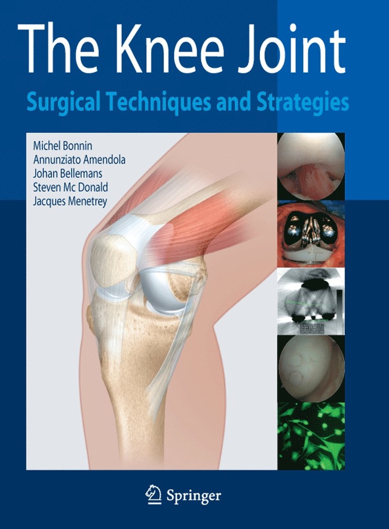 Michel Bonnin, Ned Annunziato Amendola, Johan Bellemans, Steven J. MacDonald, Jacques Menetrey - Knee Joint, Inbunden