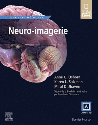 Neuro-imagerie 1