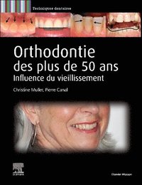 bokomslag Orthodontie des plus de 50 ans