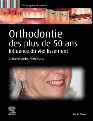 bokomslag Orthodontie des plus de 50 ans