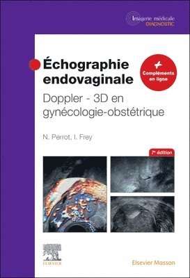 bokomslag ?chographie endovaginale Doppler - 3D