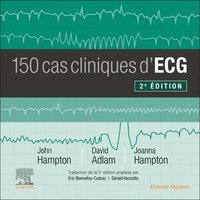 bokomslag 150 cas cliniques d'ECG