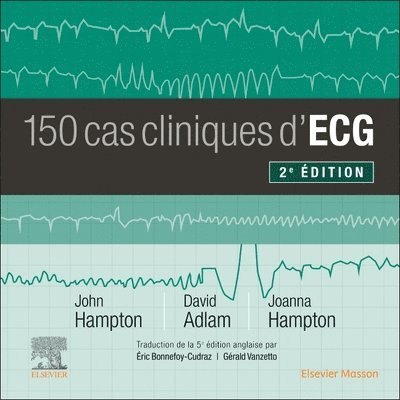 150 cas cliniques d'ECG 1