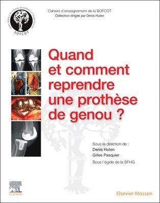 bokomslag Quand et comment reprendre une proth?se de genou ?