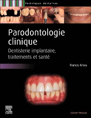 Francis Mora - Parodontologie clinique, Inbunden