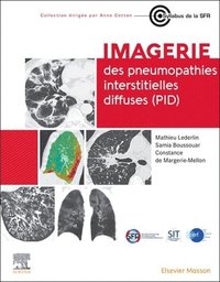 bokomslag Imagerie des pneumopathies interstitielles diffuses (PID)