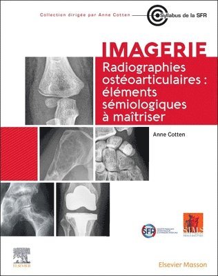 Radiographies ostoarticulaires : lments smiologiques  maitriser 1