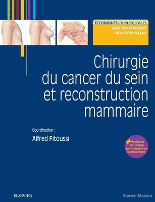 Alfred Fitoussi - Chirurgie du cancer du sein et reconstruction mammaire: Pod, Häftad