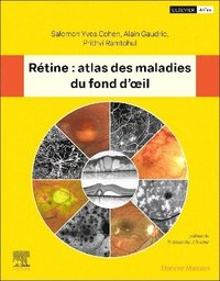 bokomslag R?tine : atlas des maladies du fond d'oeil