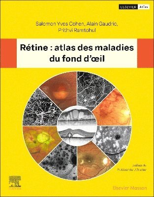 bokomslag R?tine : atlas des maladies du fond d'oeil