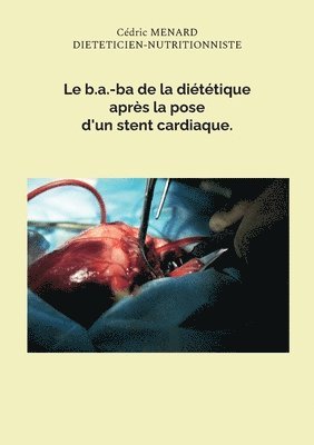 bokomslag b.a.-ba de la diététique après la pose d'un stent cardiaque.