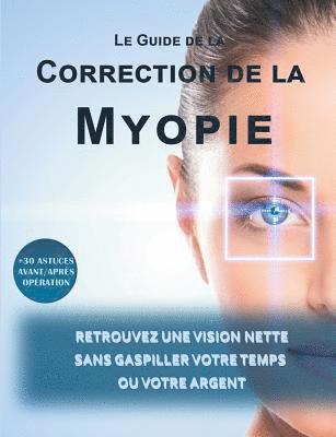 Le guide de la correction de la myopie 1