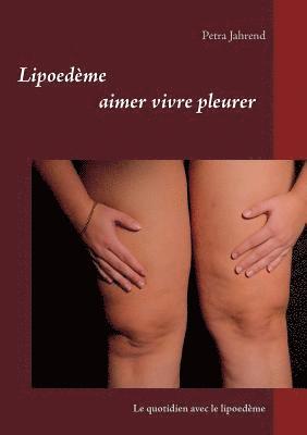 Lipoedme aimer vivre pleurer 1