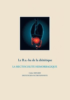 bokomslag Le B.a.-ba de la dittique de la rectocolite hmorragique