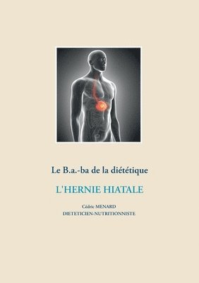 bokomslag B.a.-ba diététique de l'hernie hiatale