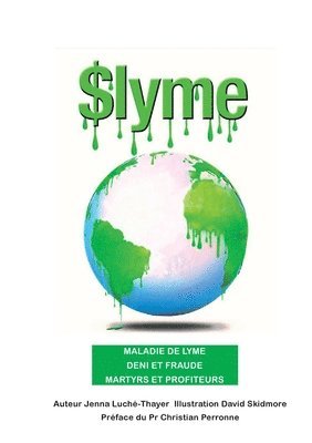 $lyme 1