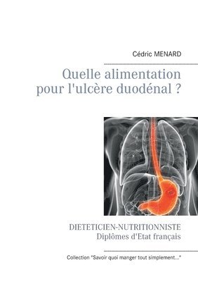 bokomslag Quelle alimentation pour l'ulcere duodenal ?