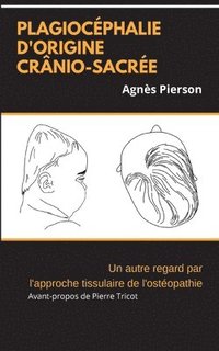bokomslag plagiocéphalie d'origine crânio-sacrée