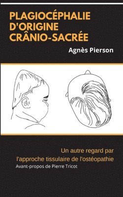 bokomslag plagiocéphalie d'origine crânio-sacrée