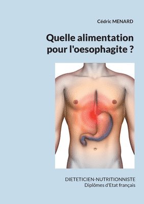 bokomslag Quelle alimentation pour l'oesophagite ?