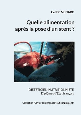 bokomslag Quelle alimentation aprs la pose d'un stent ?