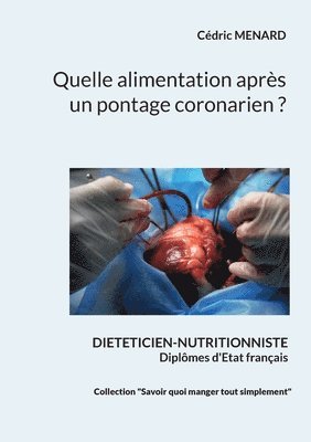 Cédric Menard - Quelle alimentation après un pontage coronarien ?, Häftad