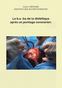 bokomslag Le b.a.-ba de la dittique aprs un pontage coronarien.