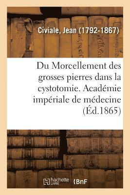 bokomslag Du Morcellement Des Grosses Pierres Dans La Cystotomie. Acadmie Impriale de Mdecine