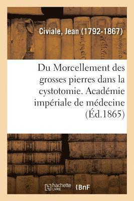 Du Morcellement Des Grosses Pierres Dans La Cystotomie. Académie Impériale de Médecine