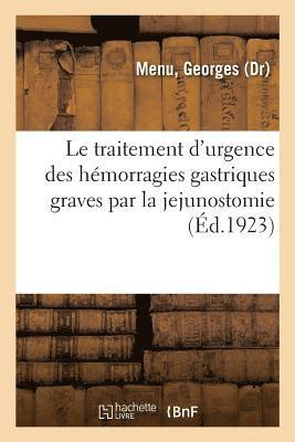 Georges Menu, MENU-G - Le Traitement d'Urgence Des Hémorragies Gastriques Graves Par La Jejunostomie, Häftad