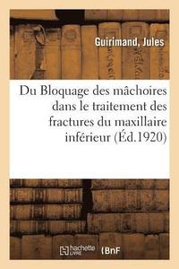 bokomslag Du Bloquage Des Machoires Dans Le Traitement Des Fractures Du Maxillaire Inferieur