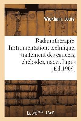 Radiumthrapie. Instrumentation, Technique, Traitement Des Cancers, Chlodes, Naevi, Lupus 1