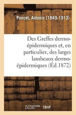 Des Greffes Dermo-pidermiques Et, En Particulier, Des Larges Lambeaux Dermo-pidermiques 1