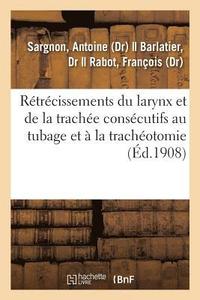 bokomslag Rétrécissements Du Larynx Et de la Trachée Consécutifs Au Tubage Et À La Trachéotomie