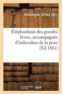 bokomslag Elephantiasis Des Grandes Levres, Accompagnee d'Induration de la Peau