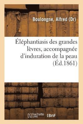 Elephantiasis Des Grandes Levres, Accompagnee d'Induration de la Peau 1