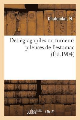 Des Egragopiles Ou Tumeurs Pileuses de l'Estomac 1