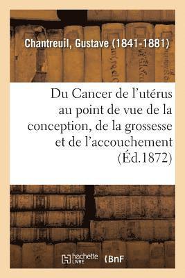 bokomslag Du Cancer de l'Utrus Au Point de Vue de la Conception, de la Grossesse Et de l'Accouchement