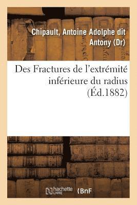bokomslag Des Fractures de l'Extrémité Inférieure Du Radius