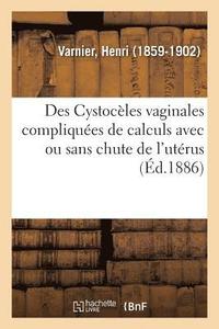 bokomslag Des Cystocles Vaginales Compliques de Calculs Avec Ou Sans Chute de l'Utrus