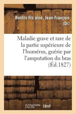 bokomslag Description Succincte d'Une Maladie Grave Et Rare de la Partie Superieure de l'Humerus