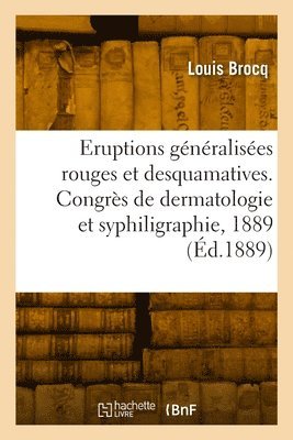 bokomslag Note sur les éruptions généralisées rouges et desquamatives, communication