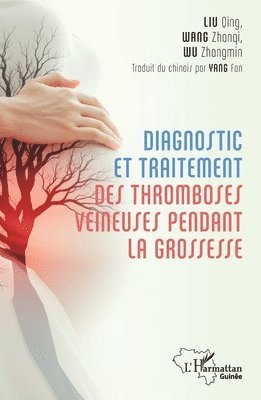 Qing Liu, Zhanqi Wang, Zhangmin Wu - Diagnostic et traitement des tromboses veineuses pendant la grossesse, Häftad