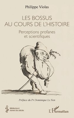 Les bossus au cours de l'histoire