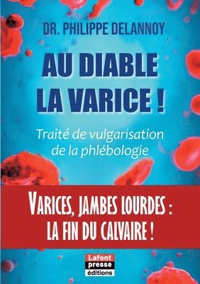 Philippe Delannoy - Au diable la varice !, Häftad