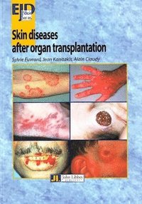 bokomslag Skin Diseases After Organ Transplantation