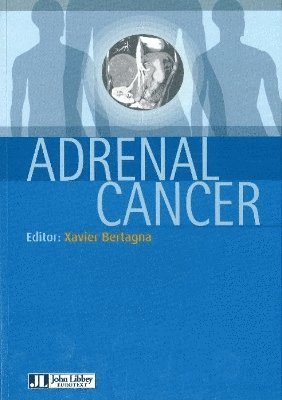 Adrenal Cancer 1